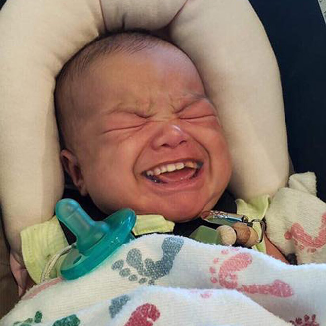Baby with adult teeth. Horrifying, isn't it?