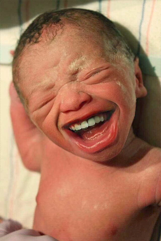 Baby with grown-up teeth. Horrifying, isn't it?