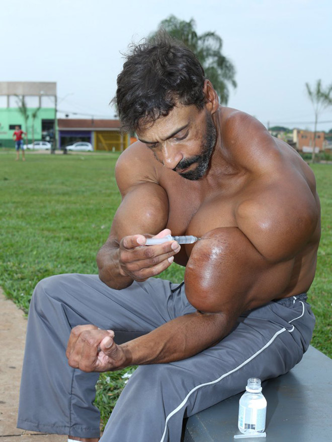 Synthol freak.