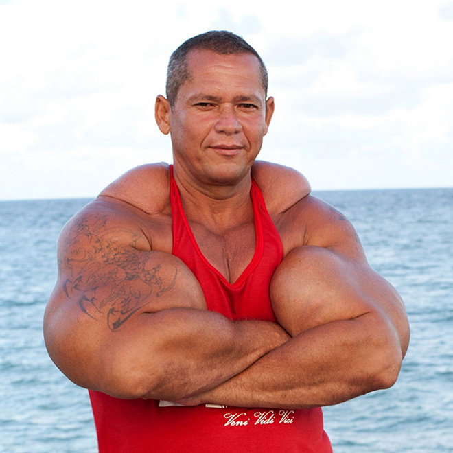 Synthol freak.