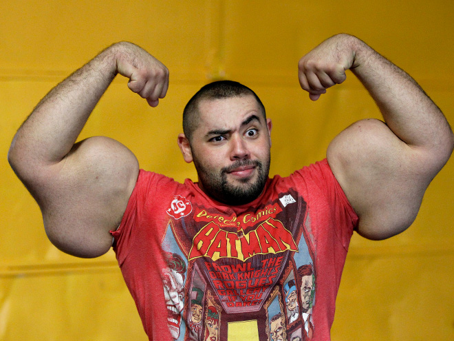 Synthol freak.