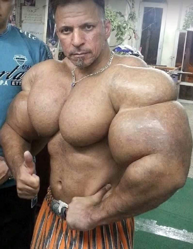 Synthol freak.