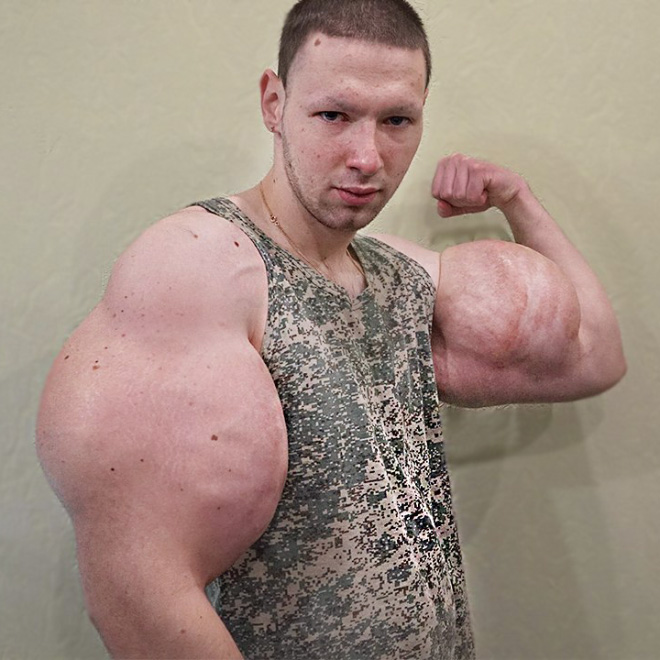 Synthol freak.