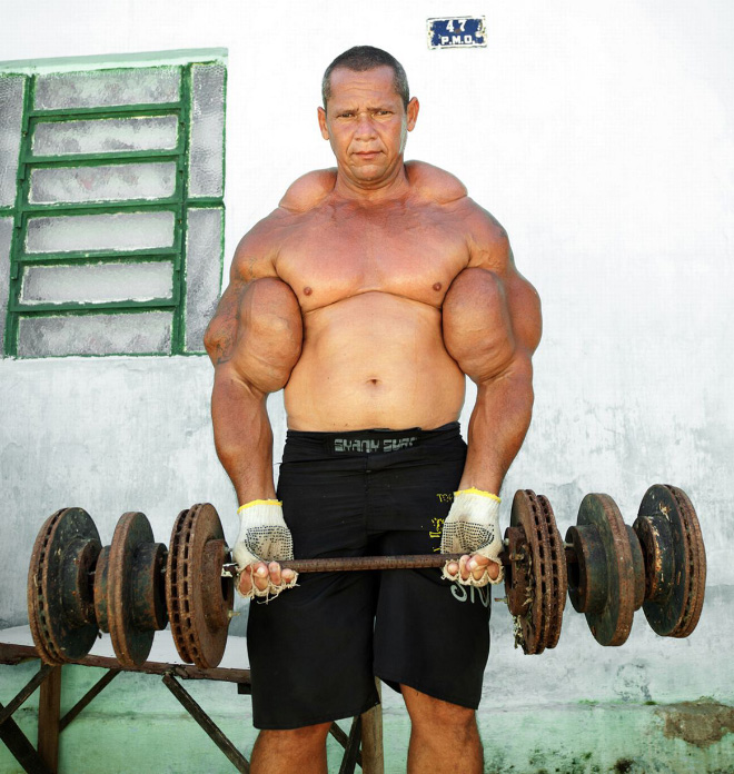 Synthol freak.