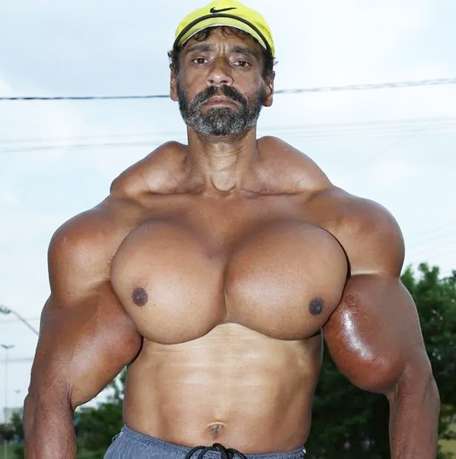 Synthol freak.