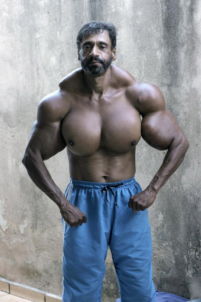 Synthol freak.