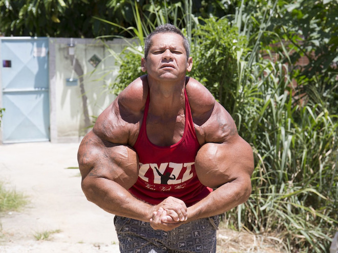 Synthol freak.