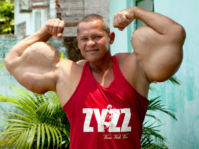 Synthol freak.