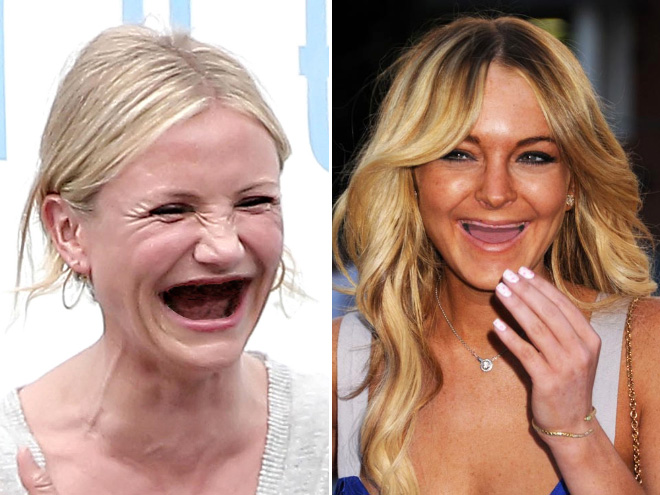 If celebrities used meth...