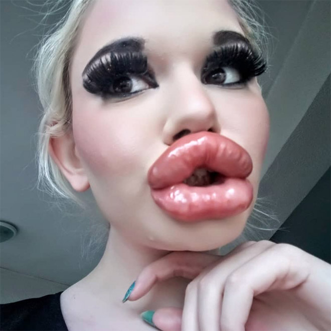 Would you kiss her?