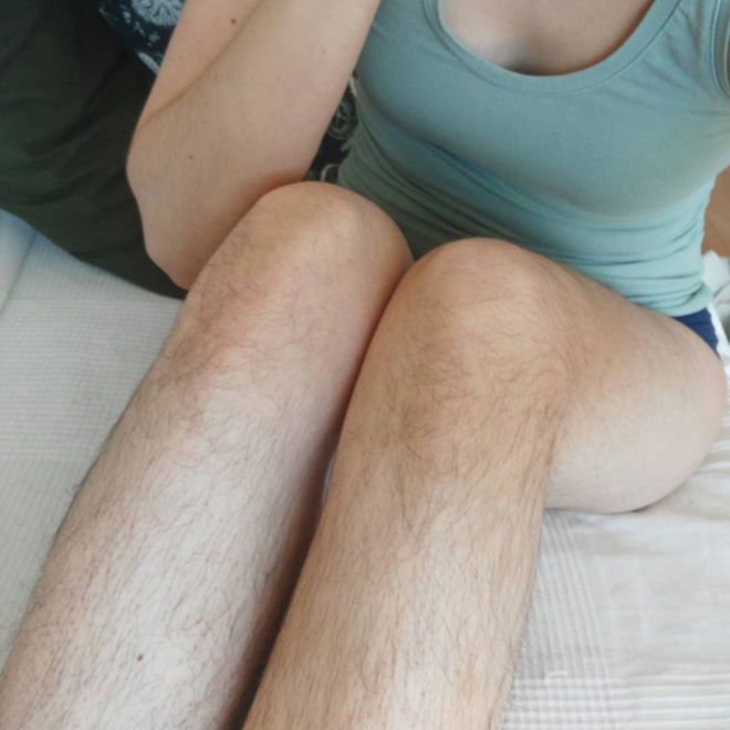 Girls with hairy legs is a real Instagram beauty trend.