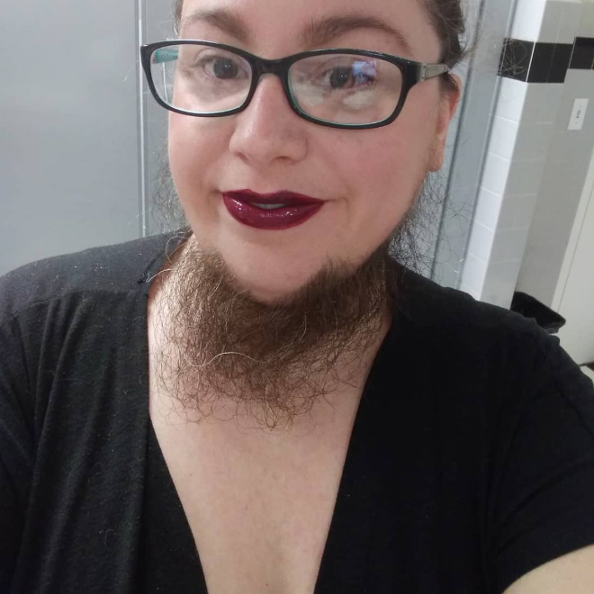 Did you know that some women can grow beards?