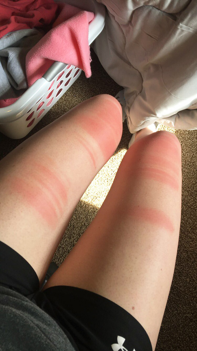Spending time in the sun while wearing ripped jeans might not be the smartest choice.