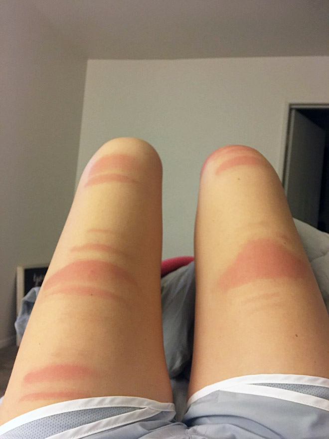 Spending time in the sun while wearing ripped jeans might not be the smartest choice.