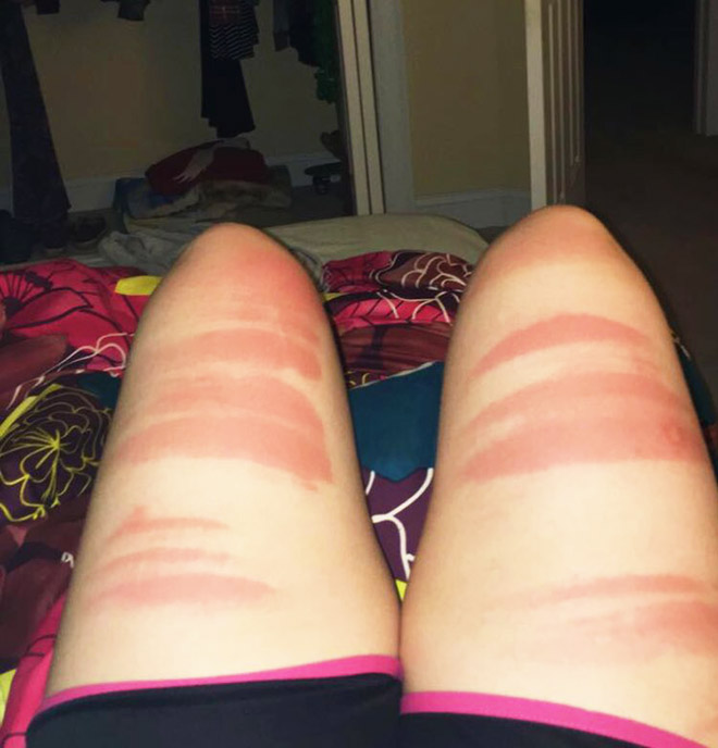 Spending time in the sun while wearing ripped jeans might not be the smartest choice.