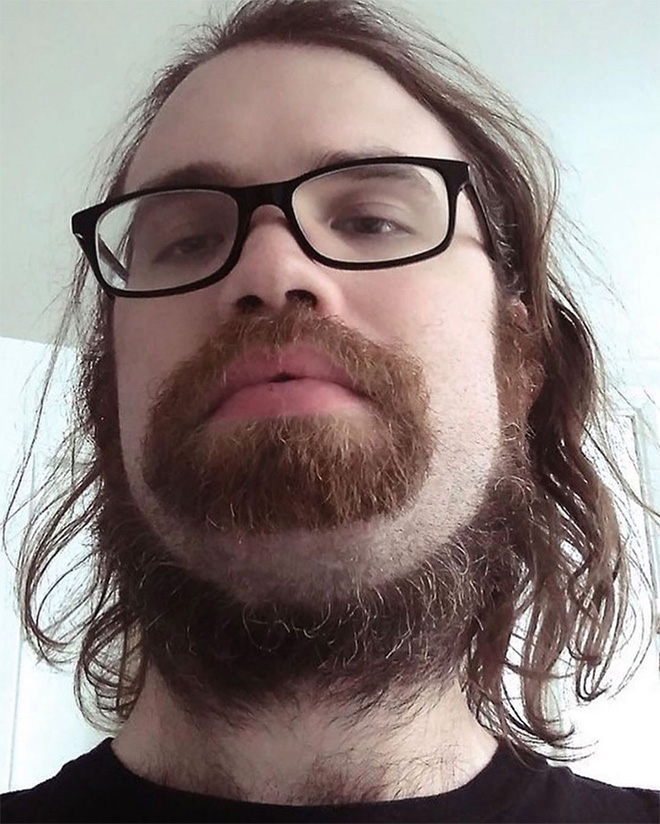 Horrifying example of neckbeard.