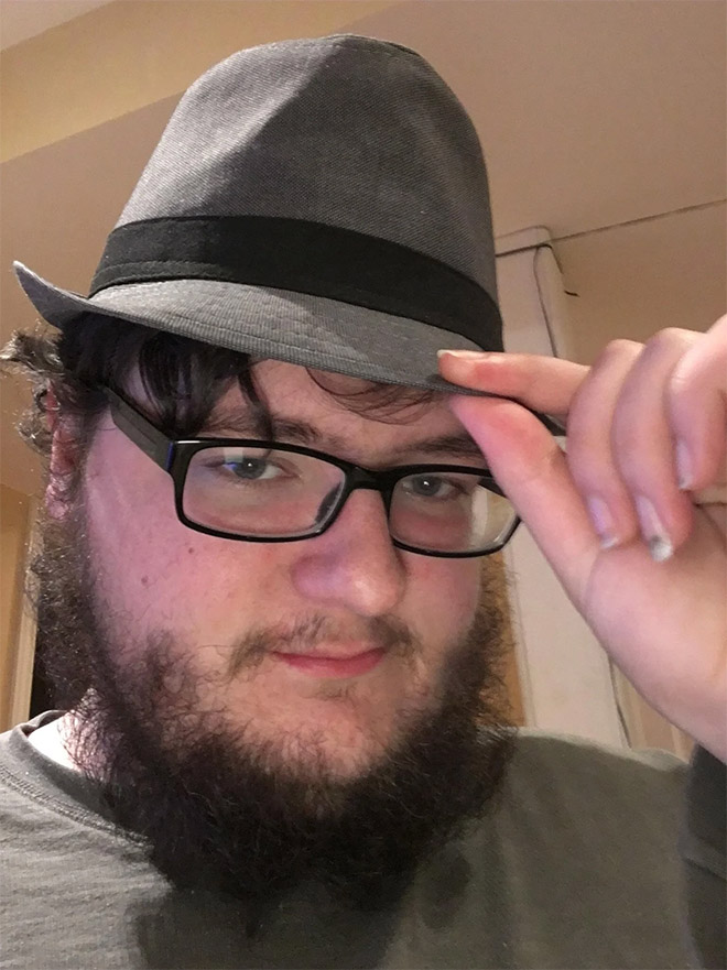 Horrifying example of neckbeard.