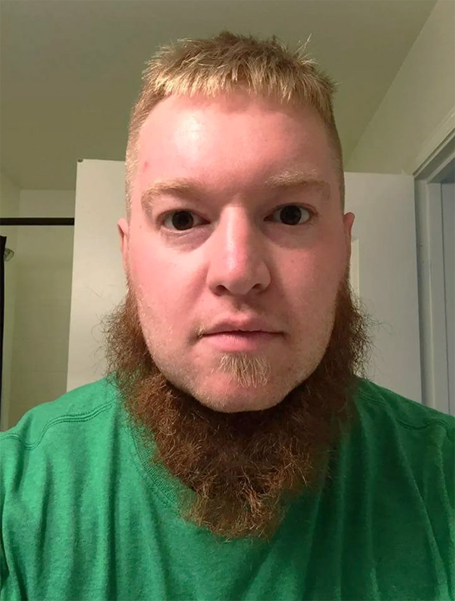 Horrifying example of neckbeard.