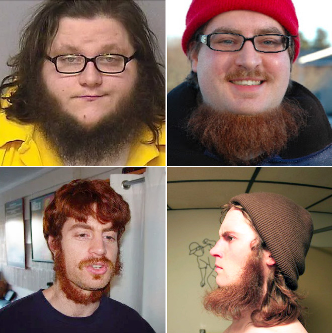 Neckbeards.