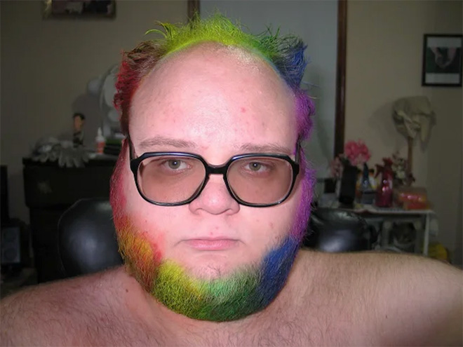 Horrifying example of neckbeard.